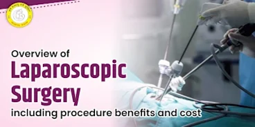 Laparoscopy Cost Guide