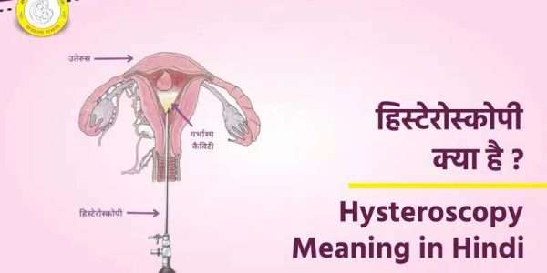 Hysteroscopy in Hindi